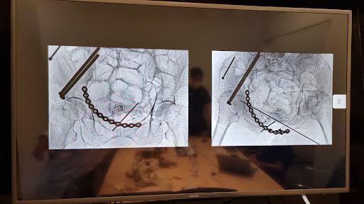 Klinik Ortopedik Terbaik di Kampung Ayer Keroh untuk Penjagaan Sendi Anda